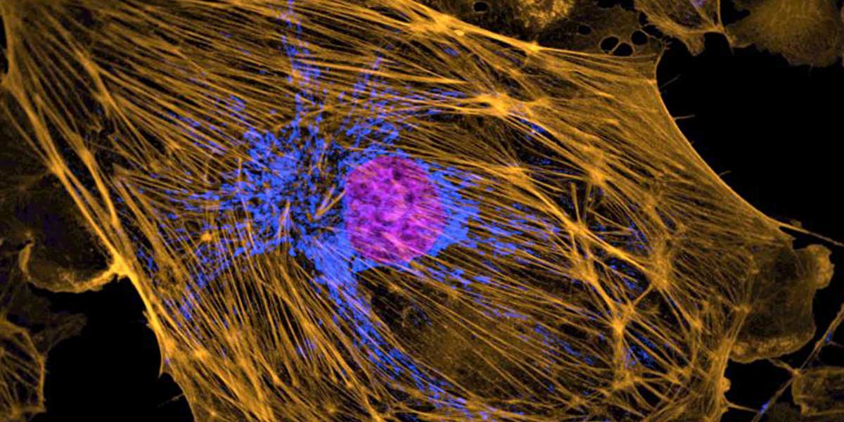 2Bovine pulmonary artery cell nucleus